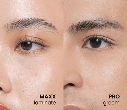 Browlift